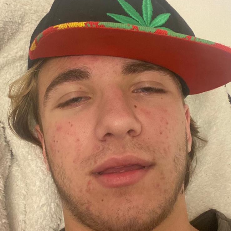 AMPHETAMINE